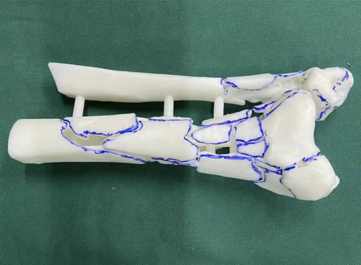 Innovative Applications of 3D Printing Simulators in Surgical Training